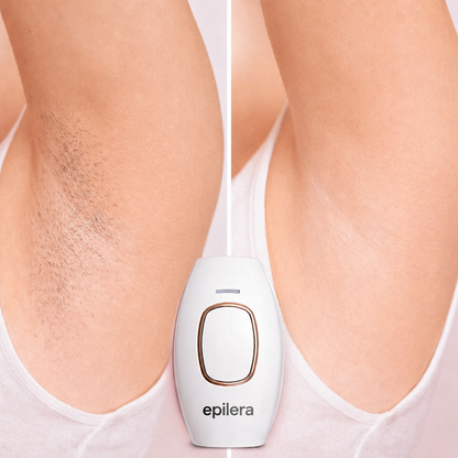 Epilera Pulse
